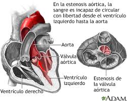 Medicamento para diabetes reduce riesgo de muerte