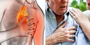Los signos silenciosos de un infarto: señales que no debes ignorar