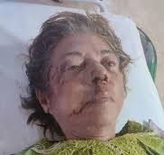 Atropellada y Abandonada: Duro golpe a Nora Susana López