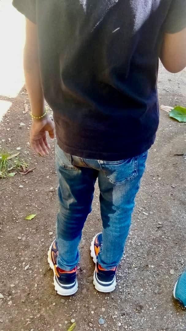 Apoyo urgente para un niño cubano con Agangliosis Total de Colon y múltiples complicaciones