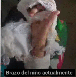Niño de 6 años es agredido con un machete por su madre y padrastro.