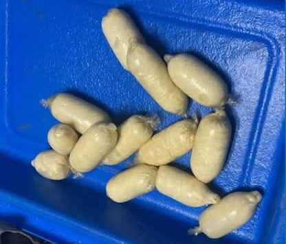 Aduana de Cuba detecta cápsulas de cocaína líquida dentro del cuerpo de un hombre en aeropuerto de La Habana