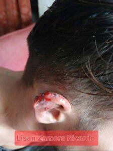 Brutal ataque contra opositor en Holguín: familia Zamora Ricardo denuncia IMPUNIDAD