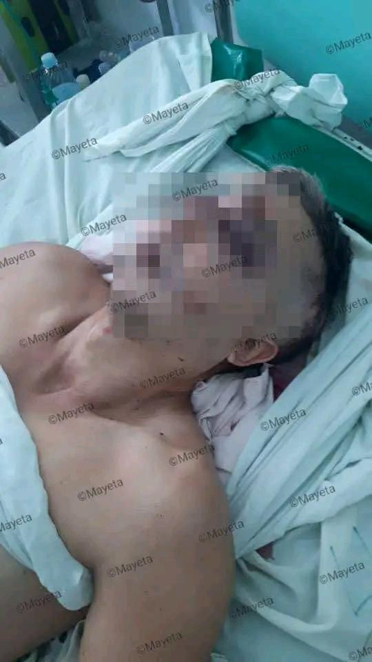 Periodista de CMKC hospitalizado