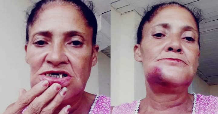 Brutal agresión a una mujer en La Habana desata ola de indignación por impunidad y trato diferenciado
