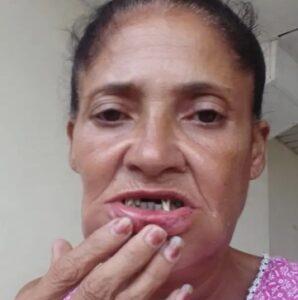 Brutal agresión a una mujer en La Habana desata ola de indignación por impunidad y trato diferenciado