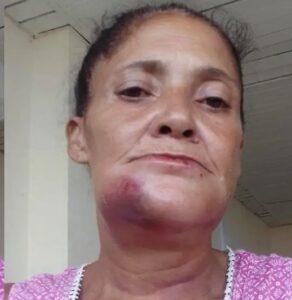 Brutal agresión a una mujer en La Habana desata ola de indignación por impunidad y trato diferenciado