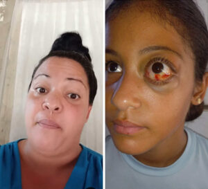 Madre de niña con tumor congénito exige respuesta definitiva a Salud Pública de Cuba