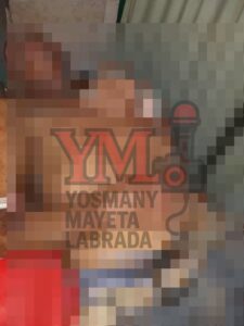 Anciano de 76 años atacado con machete en Santiago de Cuba