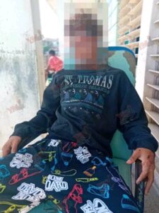 Adolescente atropellado por una pipa en Santiago de Cuba evoluciona, pero mantiene secuelas neurológicas