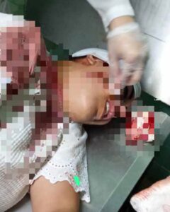 Madre denuncia brutal agresión contra su hija en La Habana: presunto agresor sigue prófugo