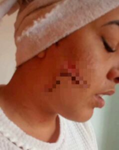 Madre denuncia brutal agresión contra su hija en La Habana: presunto agresor sigue prófugo