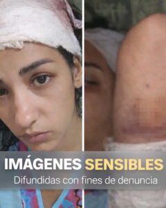 Denuncian agresor prófugo tras violento ataque con arma blanca en Bayamo