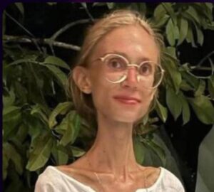 Caso Karolina Krzyzak: el peligro de las dietas extremas