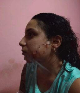 Nuevo intento de feminicidio en Camagüey: agresor continúa prófugo tras brutal ataque a joven madre
